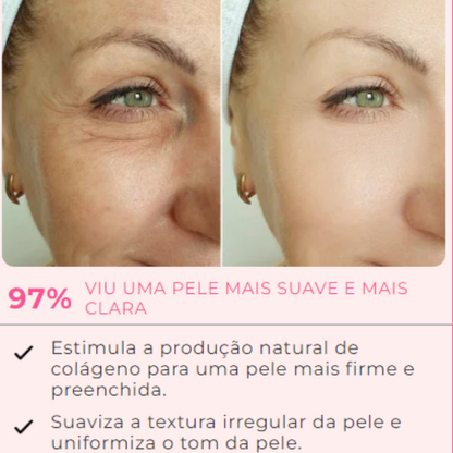 Máscara de Colágeno Verisol - Retire Imperfeições Faciais |COMPRE 1 LEVE 3|Frete Grátis