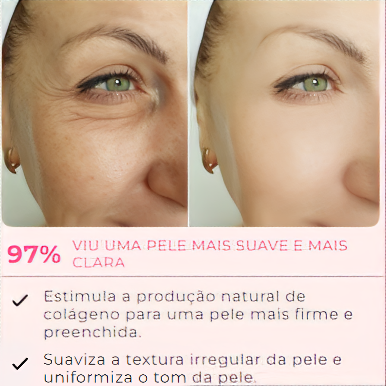 MaskLifting - Retire Imperfeições Faciais | COMPRE 1 LEVE 4 PACOTES | TRATAMENTO COMPLETO + Frete Grátis – imagem 2
