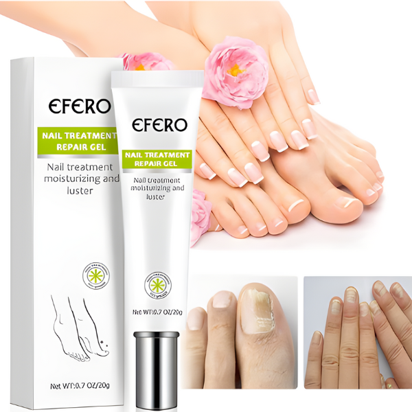 Efero Nails - Removedor de Fungos/Micoses + Fortalecimento das Unhas |COMPRE 2 LEVE 3| Frete Grátis
