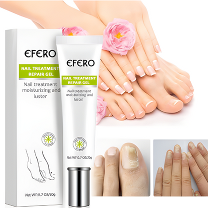 Efero Nails - Removedor de Fungos/Micoses + Fortalecimento das Unhas |COMPRE 2 LEVE 3| Frete Grátis