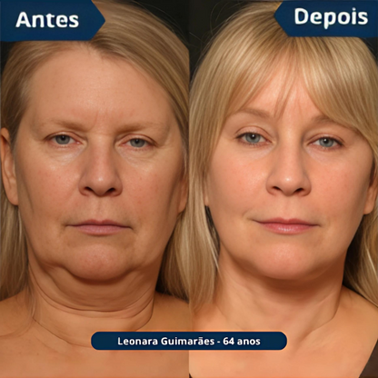 Máscara de Colágeno Verisol - Retire Imperfeições Faciais |COMPRE 1 LEVE 3|Frete Grátis