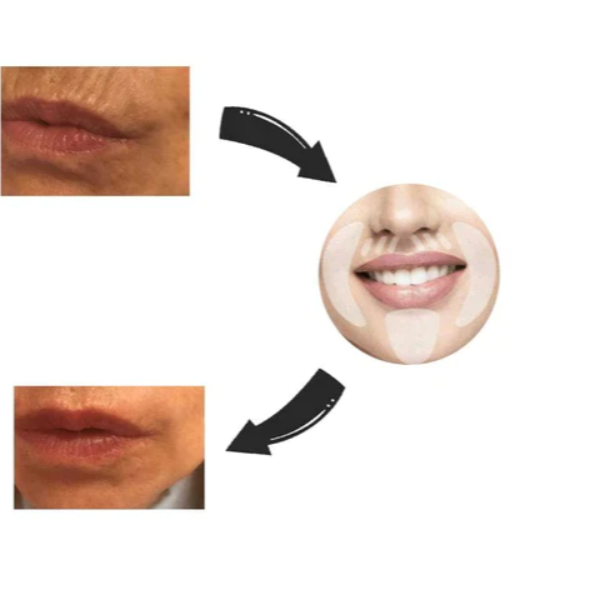 LipoFace™ - Adesivos Reutilizáveis Anti Rugas - O SEGREDO DAS FAMOSAS
