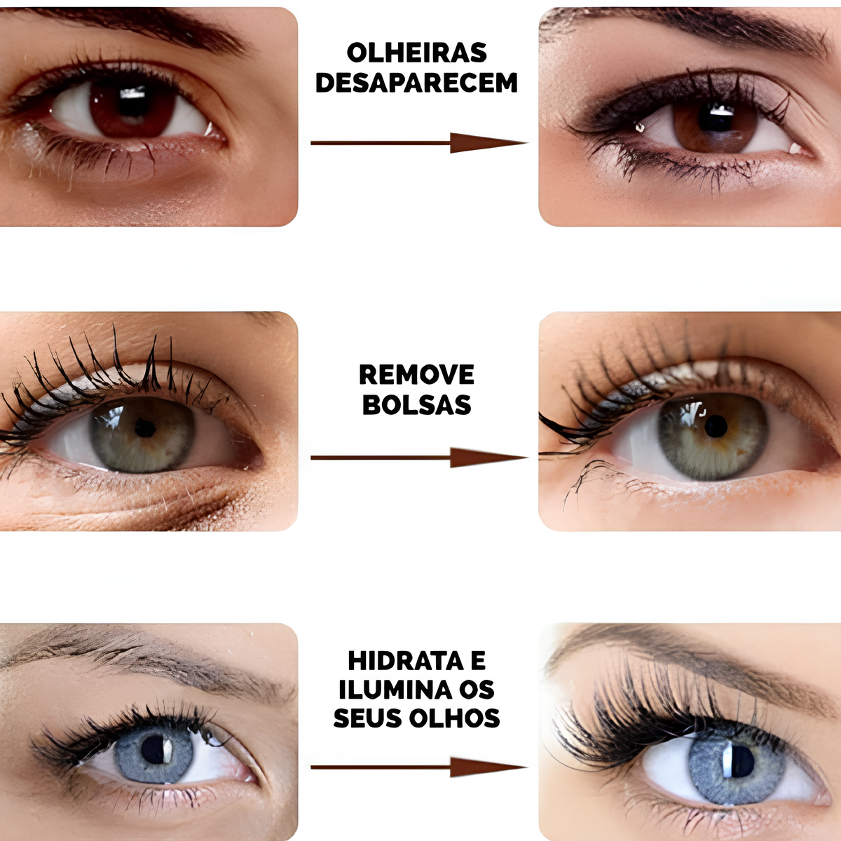 COMPRE 1 LEVE 2 - VisionSkin™ 3D  Remove Bolsas , Anti-Envelhecimento, Rugas e Inchaço – imagem 2