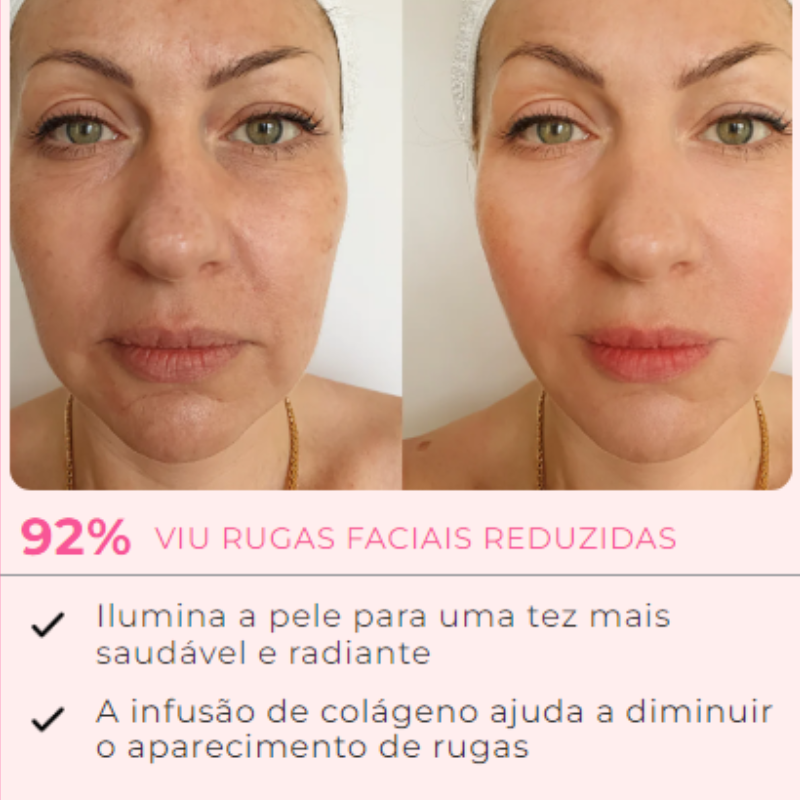 Máscara de Colágeno Verisol - Retire Imperfeições Faciais |COMPRE 1 LEVE 3|Frete Grátis