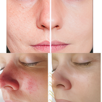 Color Correcting - Perfeição & Proteção |COMPRE 1 LEVE 2| Frete Grátis