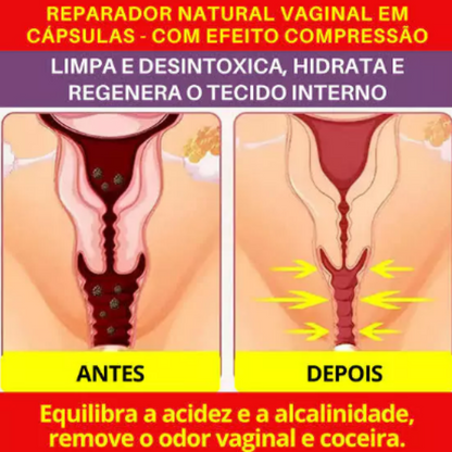 COMPRE 1 LEVE 3 - TRATAMENTO COMPLETO VagiComprex + FRETE GRÁTIS