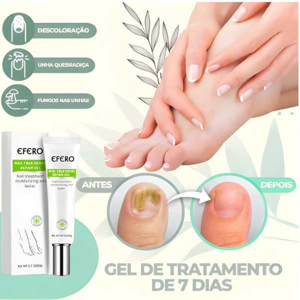 Efero Nails - Removedor de Fungos/Micoses + Fortalecimento das Unhas |COMPRE 2 LEVE 3| Frete Grátis