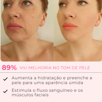 Máscara de Colágeno Verisol - Retire Imperfeições Faciais |COMPRE 1 LEVE 3|Frete Grátis