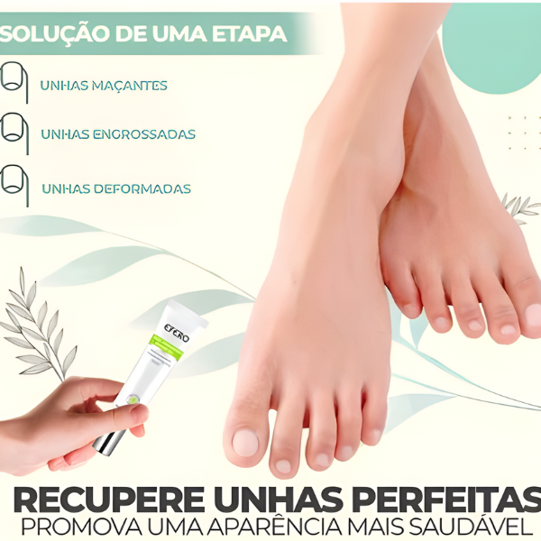 Efero Nails - Removedor de Fungos/Micoses + Fortalecimento das Unhas |COMPRE 2 LEVE 3| Frete Grátis