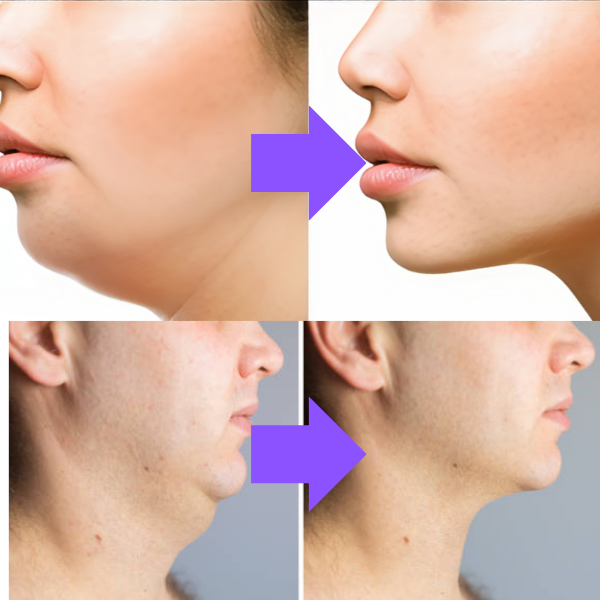 Creme LiftNeck - Revitalize sua Pele | COMPRE 1 LEVE 2 | Frete Grátis – imagem 3