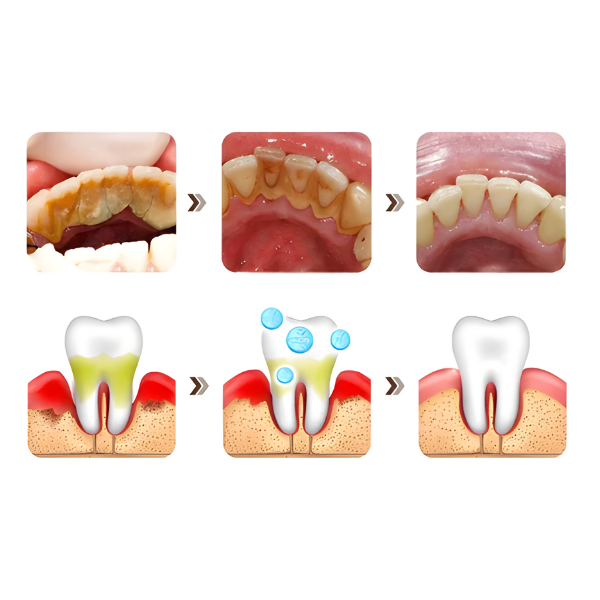 PastaClean - Remova TODAS Imperfeições Bucais | COMPRE 1 LEVE 2 + Frete GRÁTIS – imagem 7