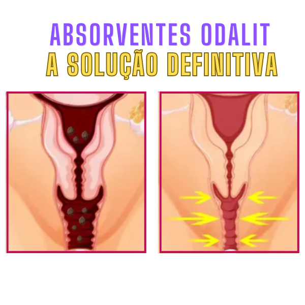 Absorventes  ODALIT™ - (Tratamento Completo 1 MÊS) - Frete Grátis – imagem 4