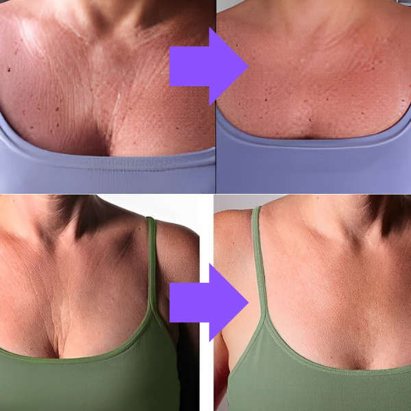 Creme LiftNeck - Revitalize sua Pele | COMPRE 1 LEVE 2 | Frete Grátis