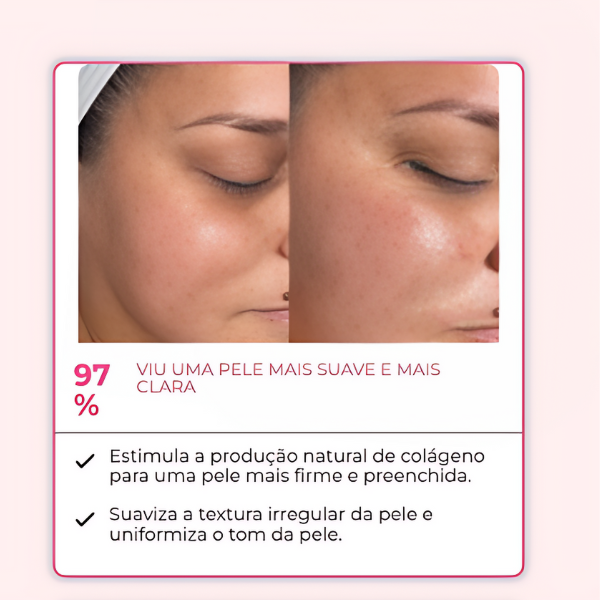 KIT RENEW 7 AMPOLAS + 1 APLICADOR DE BRINDE -  Retire IMPERFEIÇÕES *EFEITO BOTOX* | Frete Grátis