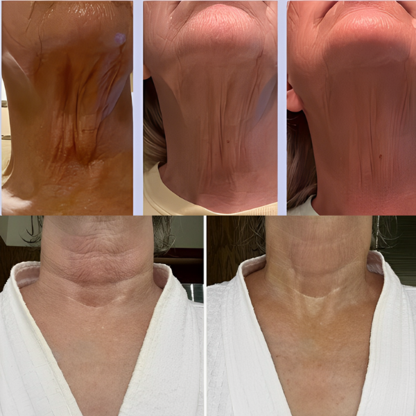 Creme LiftNeck - Revitalize sua Pele | COMPRE 1 LEVE 2 | Frete Grátis – imagem 5