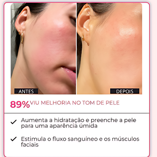 KIT RENEW 7 AMPOLAS + 1 APLICADOR DE BRINDE -  Retire IMPERFEIÇÕES *EFEITO BOTOX* | Frete Grátis – imagem 5