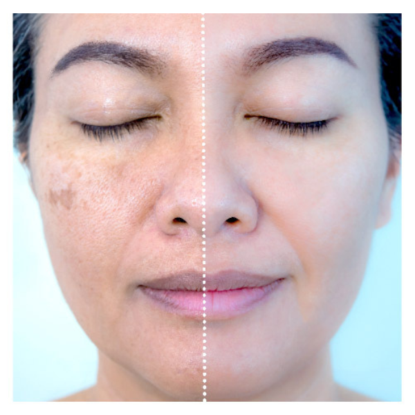 Sérum Celestial: Ação Clareadora e Antirrugas - Retire Imperfeições Faciais | COMPRE 1 LEVE 2 | Frete Grátis – imagem 2