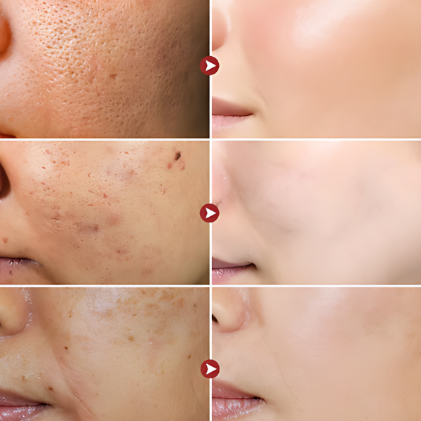 Sérum Celestial: Ação Clareadora e Antirrugas - Retire Imperfeições Faciais | COMPRE 1 LEVE 2 | Frete Grátis – imagem 8