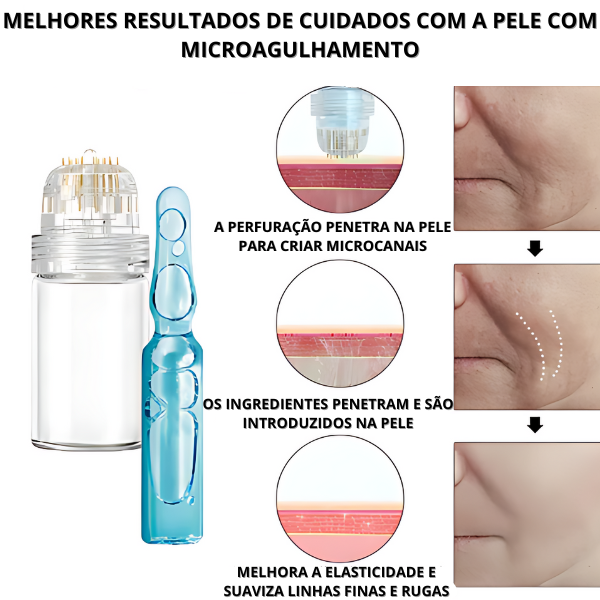 7 AMPOLAS -  Retire IMPERFEIÇÕES *EFEITO BOTOX* | Frete Grátis