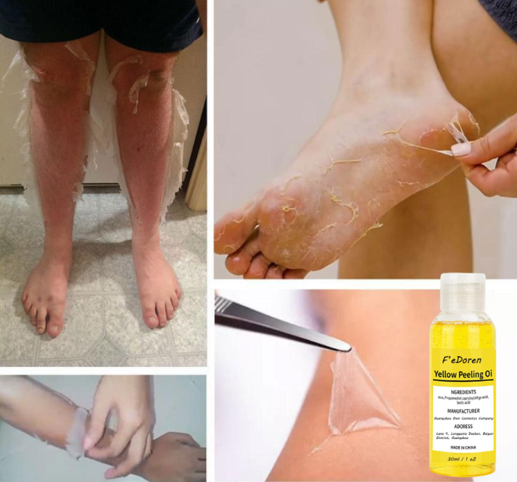 ClearSkin™ 3D - Máscara Esfoliante 6 em 1